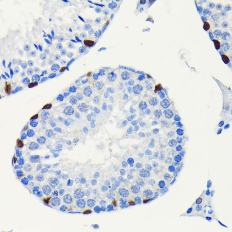 Immunohistochemistry - Anti-SOX9 Antibody [ARC0190] (A306215) - Antibodies.com