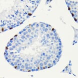Immunohistochemistry - Anti-SOX9 Antibody [ARC0190] (A306215) - Antibodies.com