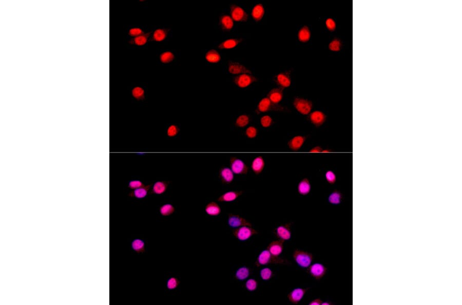 Immunofluorescence - Anti-SOX9 Antibody [ARC0190] (A306215) - Antibodies.com