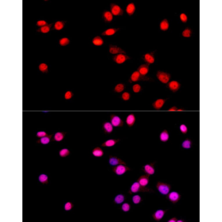 Immunofluorescence - Anti-SOX9 Antibody [ARC0190] (A306215) - Antibodies.com