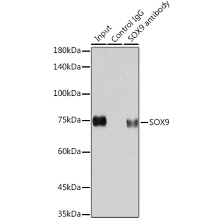 Western Blot - Anti-SOX9 Antibody [ARC0190] (A306215) - Antibodies.com