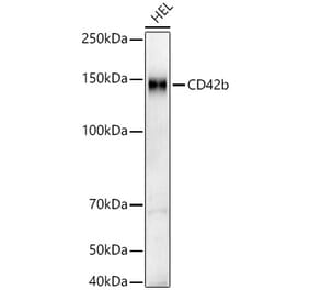 Western Blot - Anti-CD42b Antibody [ARC56624] (A306216) - Antibodies.com