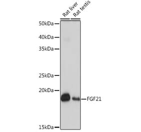 Western Blot - Anti-FGF21 Antibody [ARC53983] (A306217) - Antibodies.com