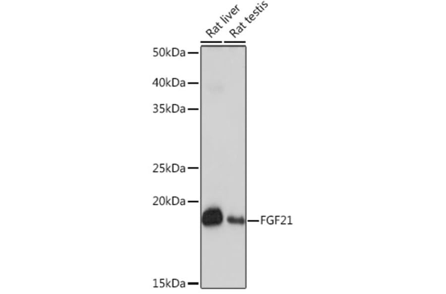 Western Blot - Anti-FGF21 Antibody [ARC53983] (A306217) - Antibodies.com