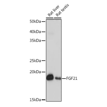 Western Blot - Anti-FGF21 Antibody [ARC53983] (A306217) - Antibodies.com