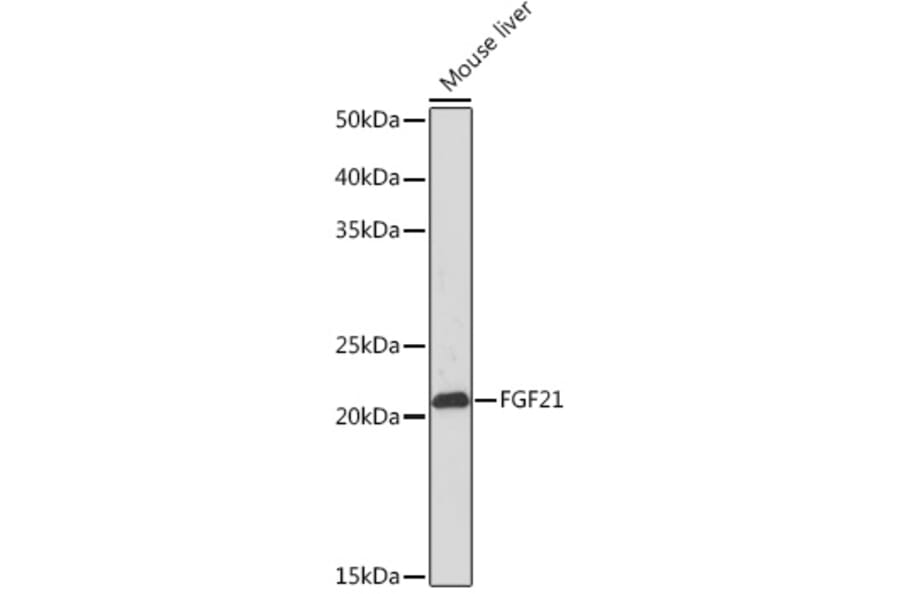 Western Blot - Anti-FGF21 Antibody [ARC53983] (A306217) - Antibodies.com