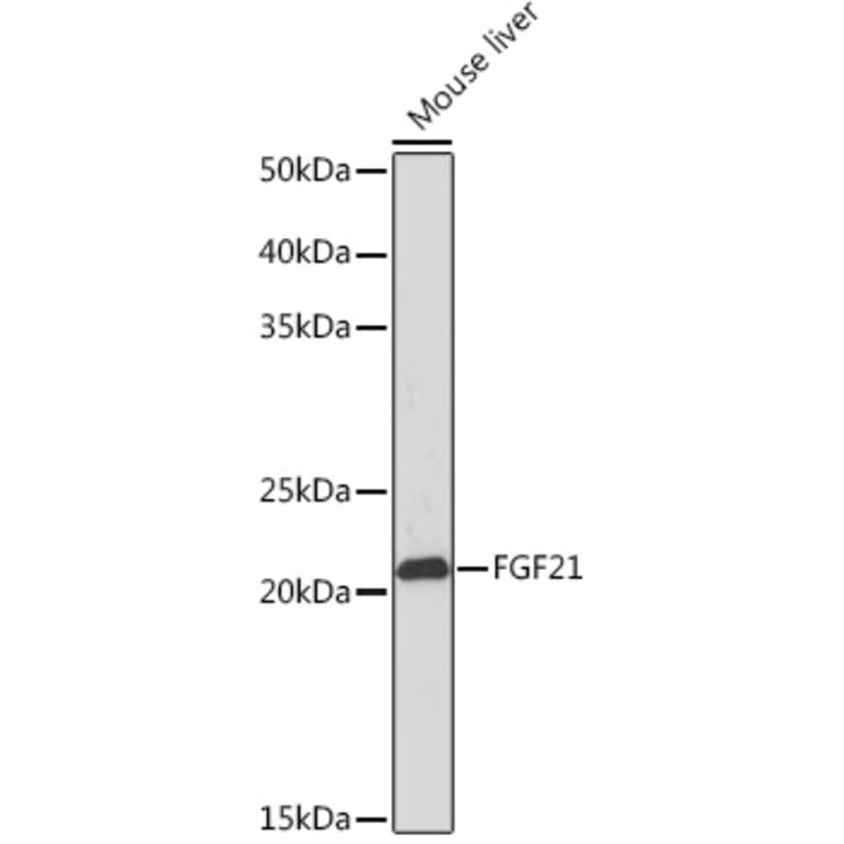 Western Blot - Anti-FGF21 Antibody [ARC53983] (A306217) - Antibodies.com