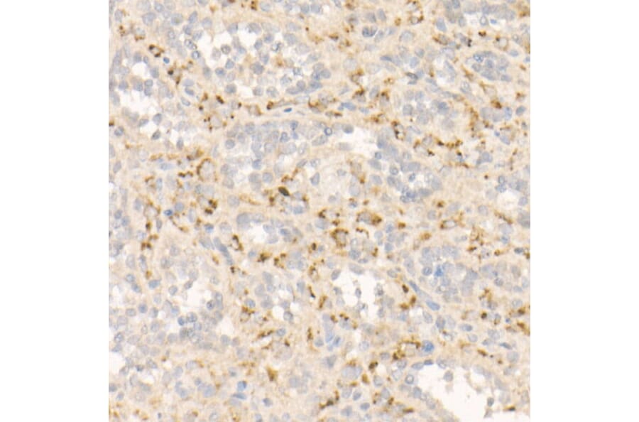 Immunohistochemistry - Anti-FGF21 Antibody [ARC53983] (A306217) - Antibodies.com