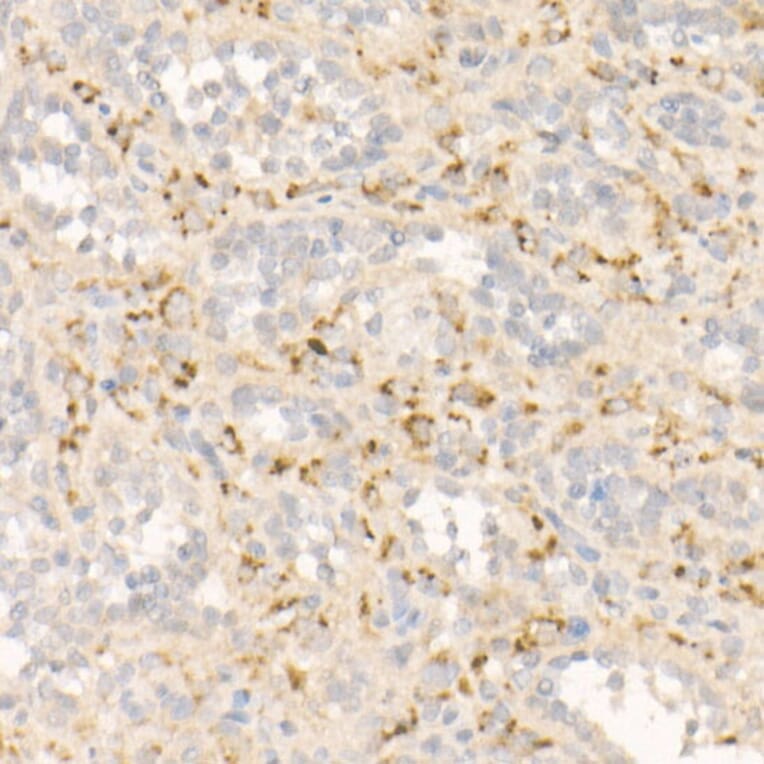 Immunohistochemistry - Anti-FGF21 Antibody [ARC53983] (A306217) - Antibodies.com