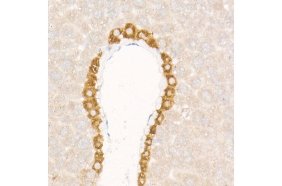 Immunohistochemistry - Anti-FGF21 Antibody [ARC53983] (A306217) - Antibodies.com