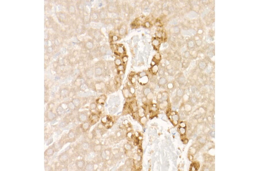 Immunohistochemistry - Anti-FGF21 Antibody [ARC53983] (A306217) - Antibodies.com