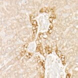 Immunohistochemistry - Anti-FGF21 Antibody [ARC53983] (A306217) - Antibodies.com