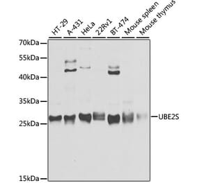 Western Blot - Anti-UBE2S Antibody (A306218) - Antibodies.com