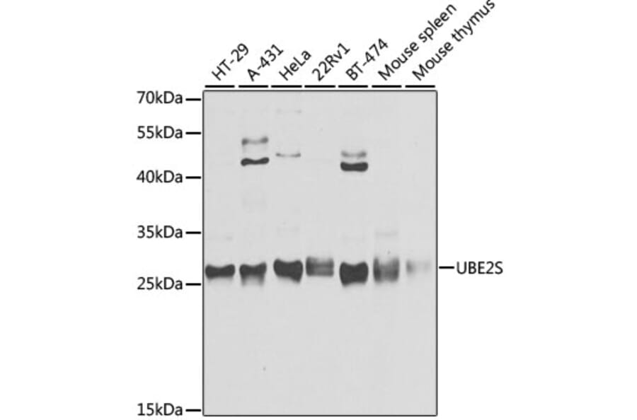 Western Blot - Anti-UBE2S Antibody (A306218) - Antibodies.com