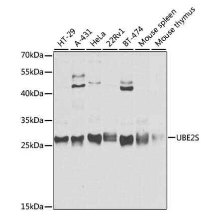 Western Blot - Anti-UBE2S Antibody (A306218) - Antibodies.com