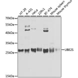 Western Blot - Anti-UBE2S Antibody (A306218) - Antibodies.com