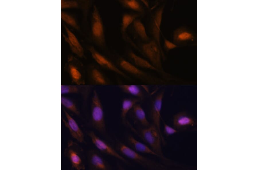 Immunofluorescence - Anti-UBE2S Antibody (A306218) - Antibodies.com