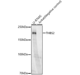 Western Blot - Anti-Thrombospondin 2 Antibody [ARC60179] (A306219) - Antibodies.com