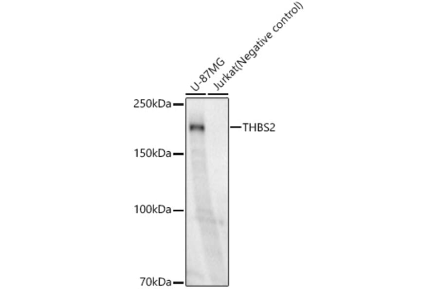 Western Blot - Anti-Thrombospondin 2 Antibody [ARC60179] (A306219) - Antibodies.com