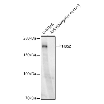 Western Blot - Anti-Thrombospondin 2 Antibody [ARC60179] (A306219) - Antibodies.com