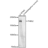 Western Blot - Anti-Thrombospondin 2 Antibody [ARC60179] (A306219) - Antibodies.com