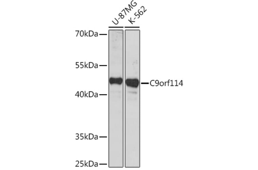 Western Blot - Anti-SPOUT1 Antibody (A306220) - Antibodies.com