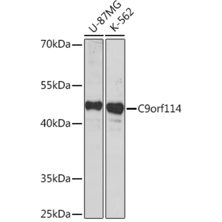 Western Blot - Anti-SPOUT1 Antibody (A306220) - Antibodies.com