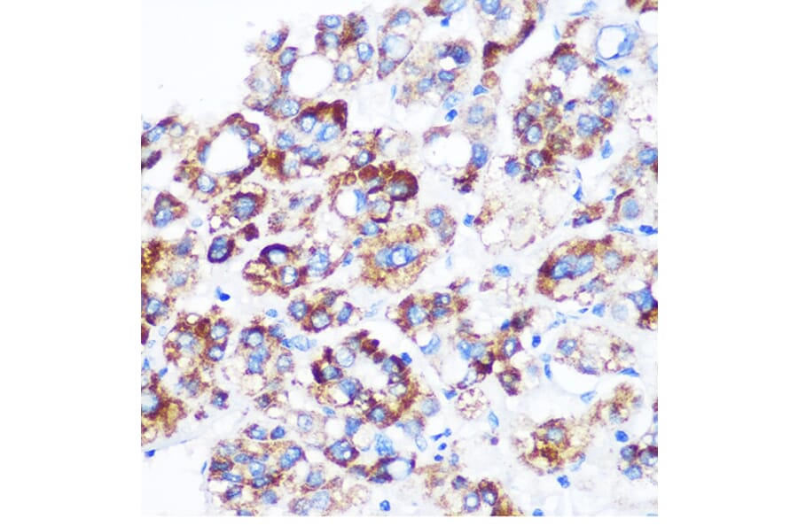 Immunohistochemistry - Anti-SPOUT1 Antibody (A306220) - Antibodies.com