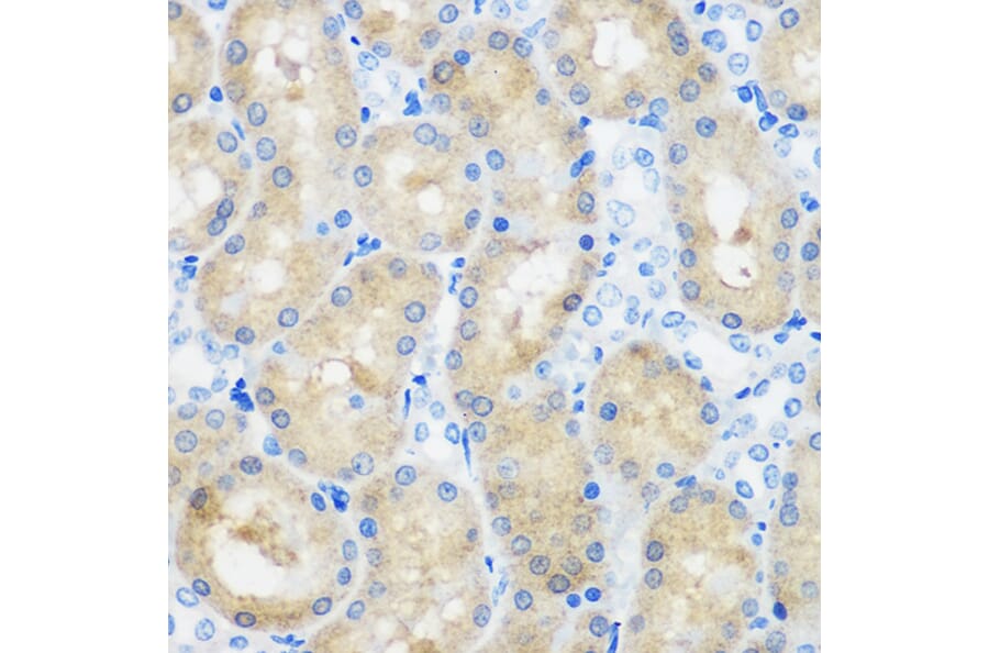 Immunohistochemistry - Anti-SPOUT1 Antibody (A306220) - Antibodies.com