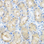 Immunohistochemistry - Anti-SPOUT1 Antibody (A306220) - Antibodies.com