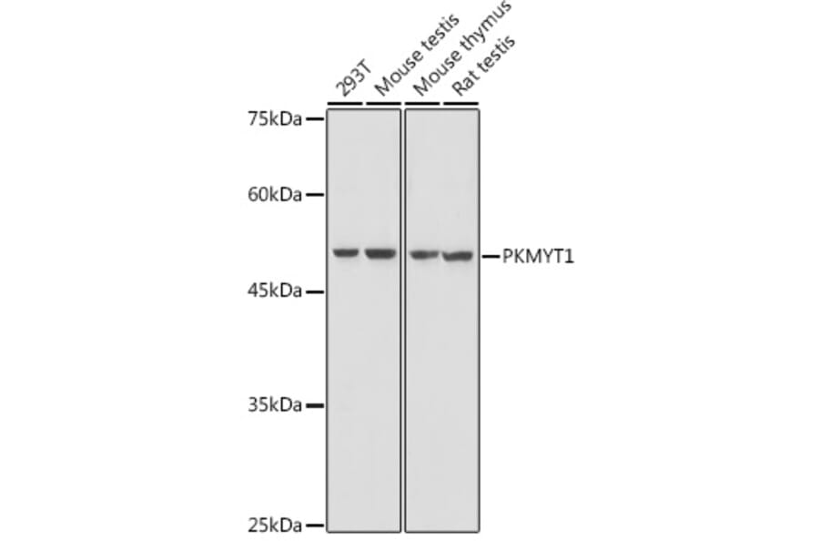 Western Blot - Anti-PKMYT1 Antibody (A306221) - Antibodies.com