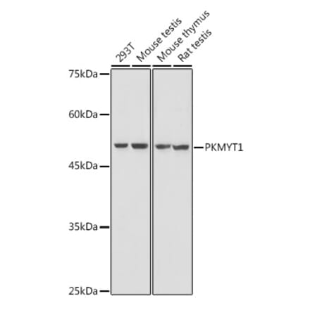 Western Blot - Anti-PKMYT1 Antibody (A306221) - Antibodies.com
