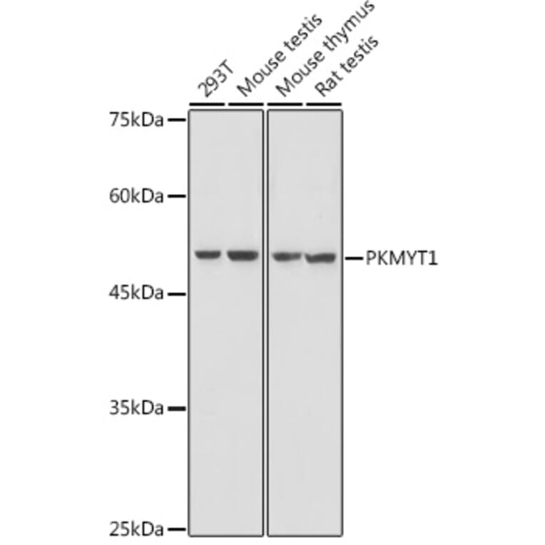 Western Blot - Anti-PKMYT1 Antibody (A306221) - Antibodies.com
