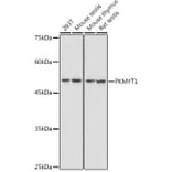 Western Blot - Anti-PKMYT1 Antibody (A306221) - Antibodies.com