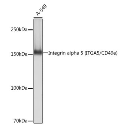 Western Blot - Anti-Integrin alpha 5 Antibody [ARC0370] (A306223) - Antibodies.com