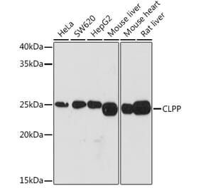 Western Blot - Anti-CLPP Antibody [ARC1929] (A306224) - Antibodies.com