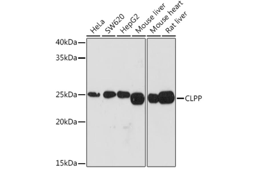 Western Blot - Anti-CLPP Antibody [ARC1929] (A306224) - Antibodies.com