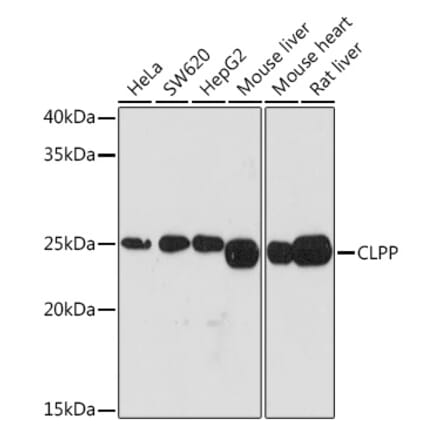 Western Blot - Anti-CLPP Antibody [ARC1929] (A306224) - Antibodies.com