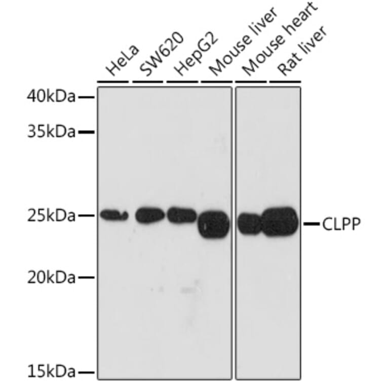 Western Blot - Anti-CLPP Antibody [ARC1929] (A306224) - Antibodies.com
