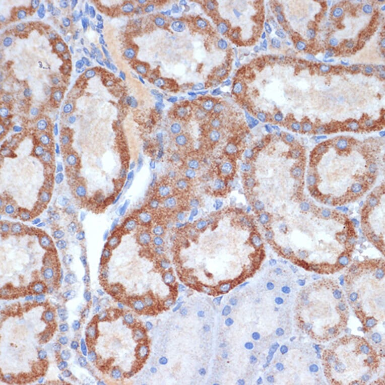 Immunohistochemistry - Anti-CLPP Antibody [ARC1929] (A306224) - Antibodies.com