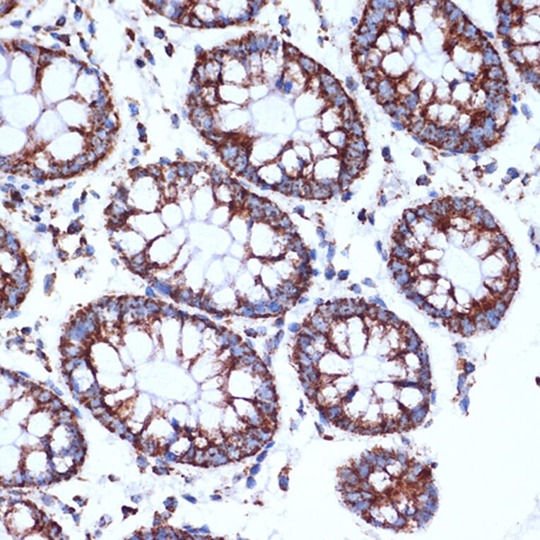 Immunohistochemistry - Anti-CLPP Antibody [ARC1929] (A306224) - Antibodies.com