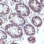 Immunohistochemistry - Anti-CLPP Antibody [ARC1929] (A306224) - Antibodies.com