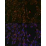 Immunofluorescence - Anti-CLPP Antibody [ARC1929] (A306224) - Antibodies.com