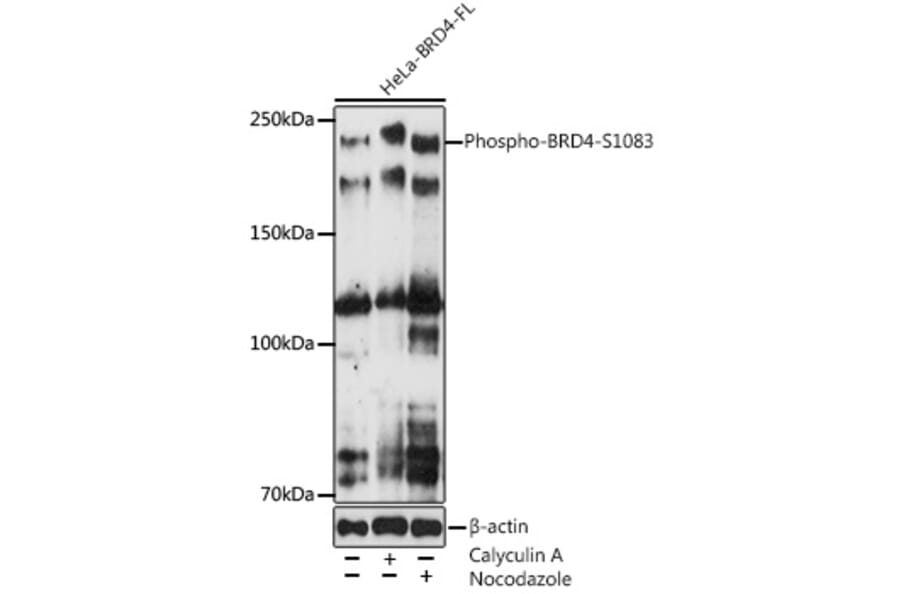 Western Blot - Anti-Brd4 (phospho Ser1083) Antibody [ARC5019-01] (A306225) - Antibodies.com