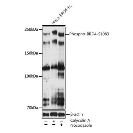 Western Blot - Anti-Brd4 (phospho Ser1083) Antibody [ARC5019-01] (A306225) - Antibodies.com