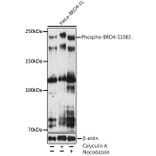 Western Blot - Anti-Brd4 (phospho Ser1083) Antibody [ARC5019-01] (A306225) - Antibodies.com