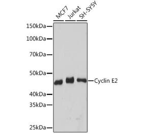Western Blot - Anti-Cyclin E2 Antibody [ARC1515] (A306226) - Antibodies.com