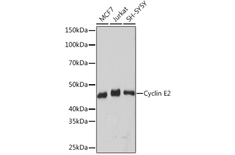 Western Blot - Anti-Cyclin E2 Antibody [ARC1515] (A306226) - Antibodies.com