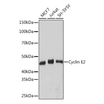 Western Blot - Anti-Cyclin E2 Antibody [ARC1515] (A306226) - Antibodies.com
