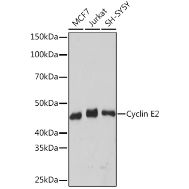 Western Blot - Anti-Cyclin E2 Antibody [ARC1515] (A306226) - Antibodies.com